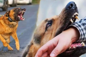 kuduz_nedir_neden_olur_insanda_kuduz_belirtileri_kac_gunde_cikar_kuduz_nasil_bulasir_1697898708_2734