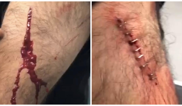 InShot_20251130_132655460