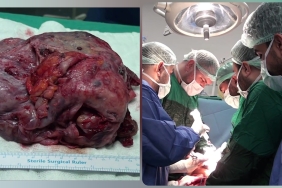 InShot_20251225_094210938