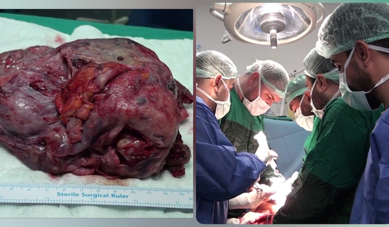 InShot_20251225_094210938